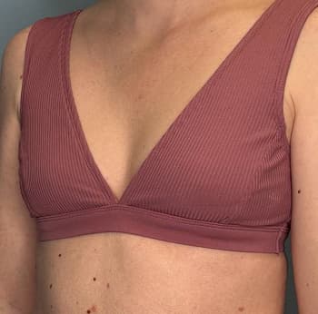 Woman before breast augmentation